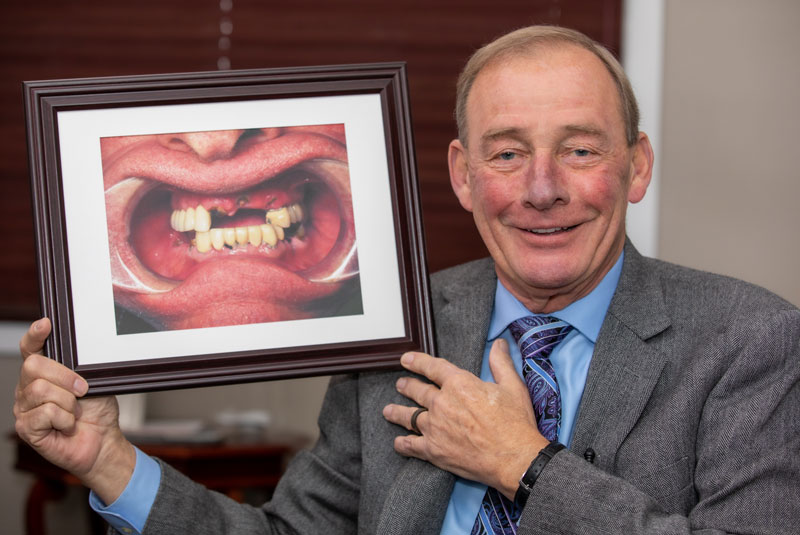 dental patient smiling after procedure