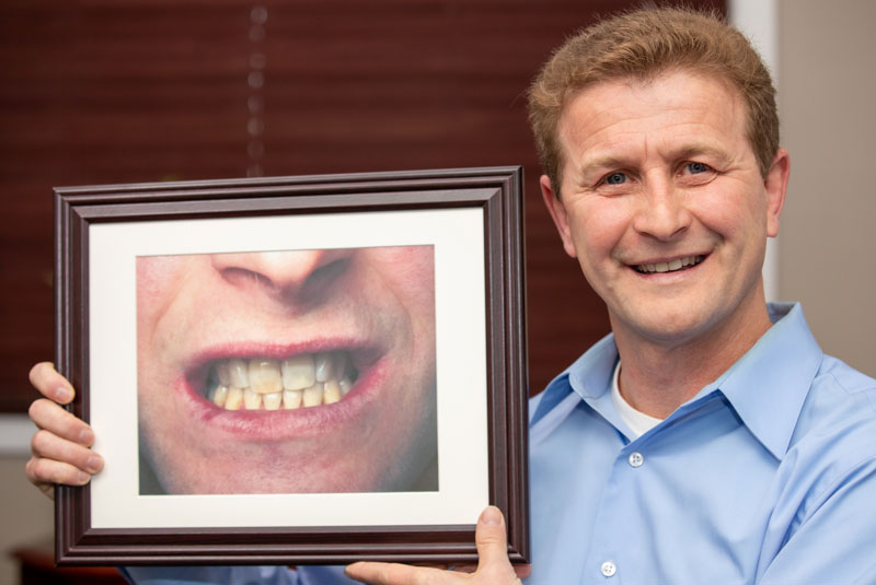 dental patient smiling after procedure