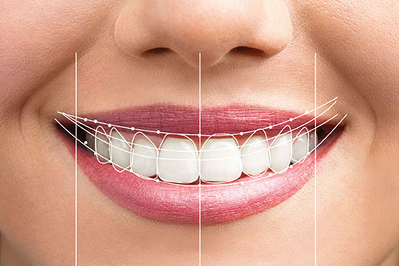 smile design graphic