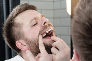 Dental Implant Patient Missing A Top Right Premolar